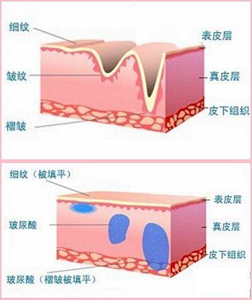 伍德布鲁斯的异想天开之旅 视频缩略图