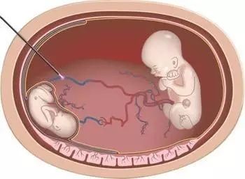 余笙是你 视频海报